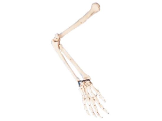 KM/11124 Arm bone model