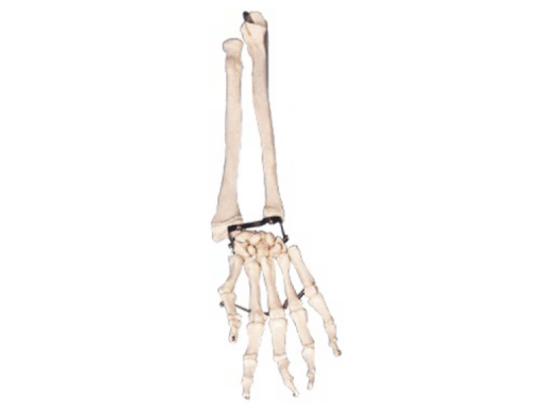 KM/11125 Palm bone with elbow bone and radial bone model