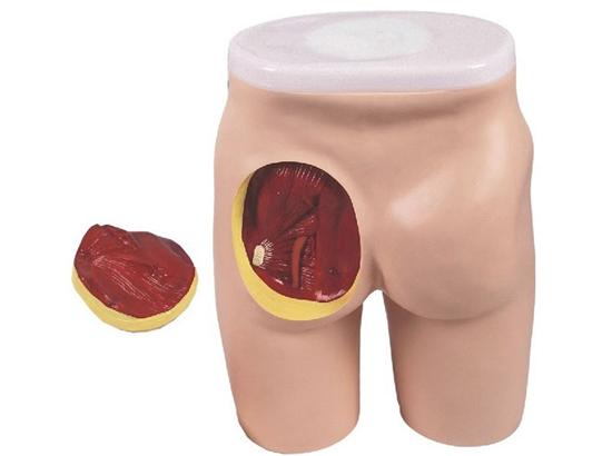 KM/T3 Buttocks Intramuscular Injection and Anatomic Structure Model